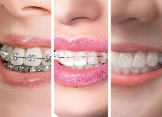 تحویل و آموزش استفاده از الاینر