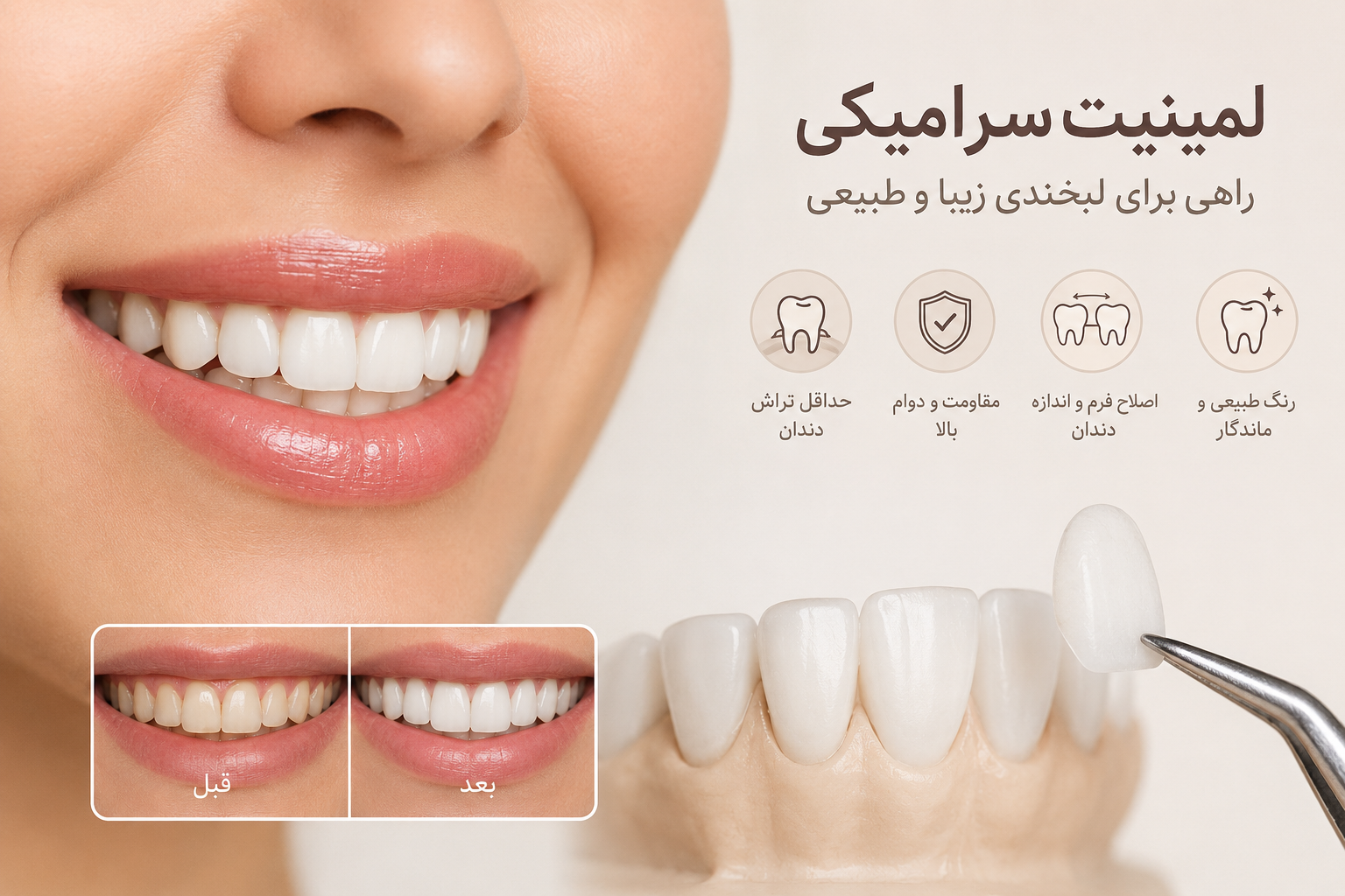لمینیت سرامیکی دندان؛ هر آنچه باید قبل از انجام آن بدانید